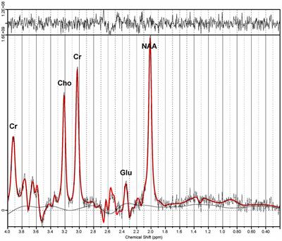 An Exploratory Study of Spectroscopic Glutamatergic Correlates of Cortical Excitability in Depressed Adolescents